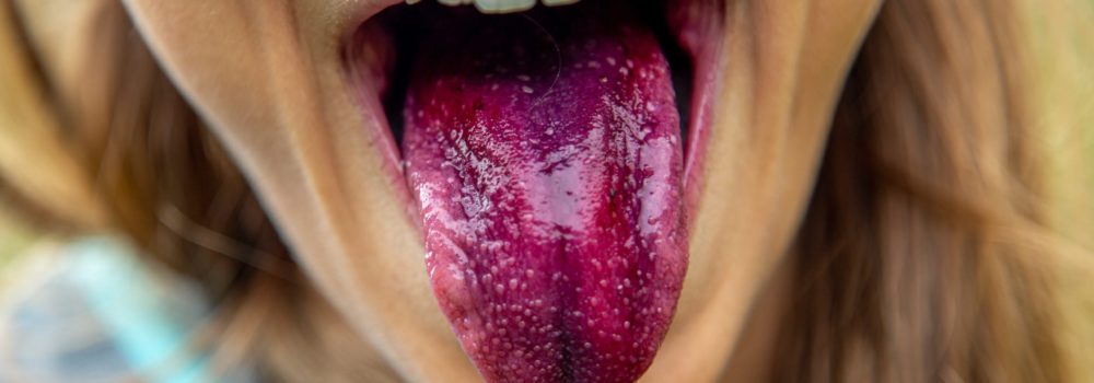 Die Zunge in der Chinesischen Medizin 12